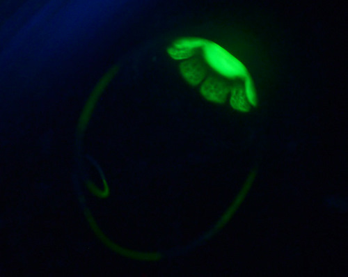 Solmundella, a narcomedusa, exhibits vivid fluorescence when viewed in the lab under blue light. Photo by Steve Haddock.