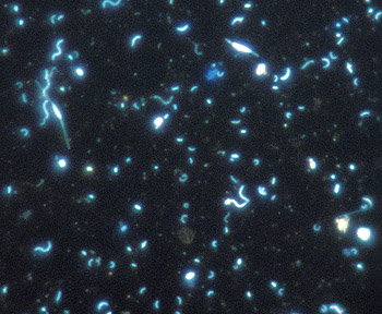 Despite the amazing diversity of marine microbes, a new research paper shows that many different groups work together to obtain nutrition from their surroundings. Image: Ed DeLong © 2000 MBARI