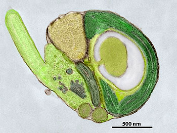 This transmission electron microscope image shows a cross section through a single Micromonas alga. In this