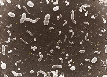 Thousands of different types of microbes inhabit every cubic centimeter of seawater. Although a few types of microbes been studied in detail, DNA studies will help scientists learn about the many species that have yet to be identified. Image: Ed DeLong (c) 2000 MBARI