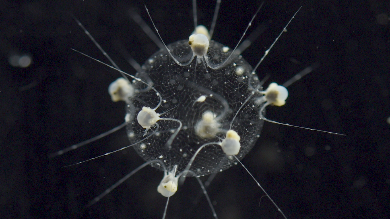 A darkfield light microscope image of a phaeodarian colony.