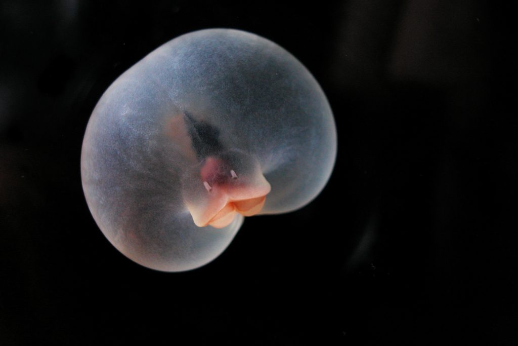 A pigbutt worm with a peach-colored, dimpled balloon-like body drifts in a laboratory tank. The background is solid black.