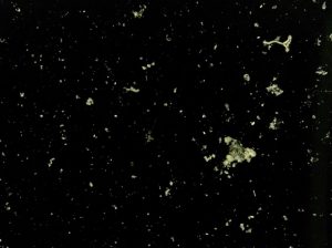 Tiny particles of yellowish-brown organic material collect on the lens of a camera system moored to the deep seafloor. The background is solid black.